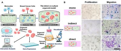 Modeling development of breast cancer: from tumor microenvironment to preclinical applications